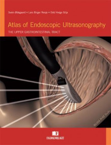 Atlas of endoscopic ultrasonography av Svein Ødegaard, Lars Birger Nesje og Odd Helge Gilja (Innbundet)